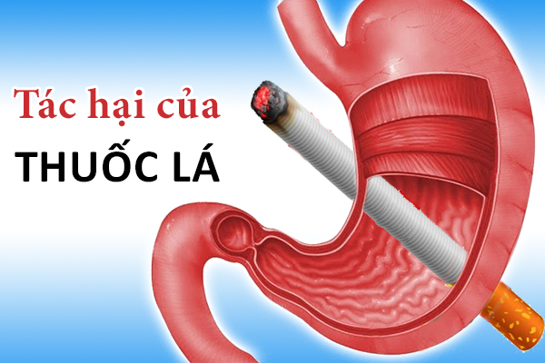 Bàng hoàng trước tác hại của thuốc lá trên dạ dày - Bỏ ngay kẻo muộn